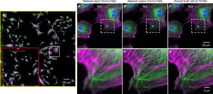 Deep learning cross-modality super-resolution microscopy results
